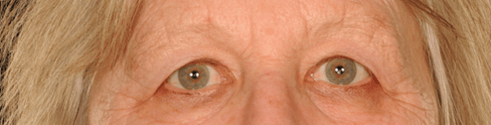 Picture11