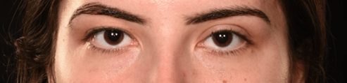 Picture25