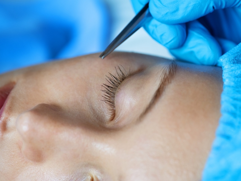 White woman aesthetic and cosmetic surgery concept